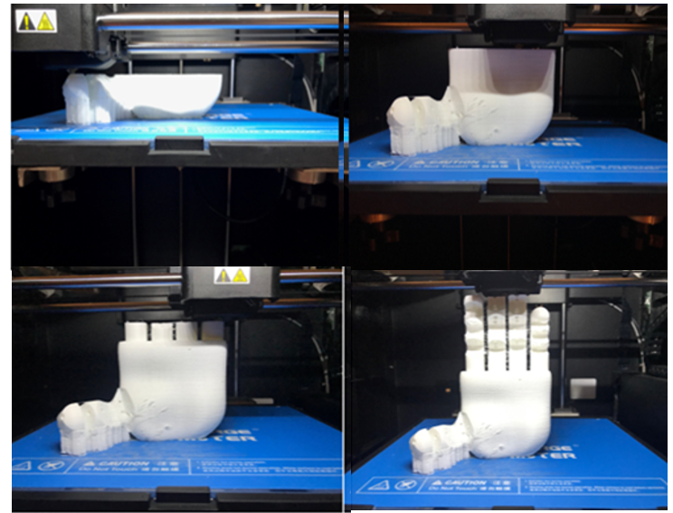 Flexure Hinge-Based Prosthetic Hand — Printed in One-go – photo 3